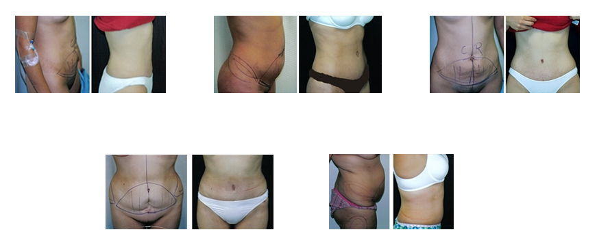 Patients Before and After Photos