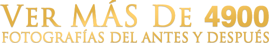 Ver mas 4800 fotografias del antes y despues